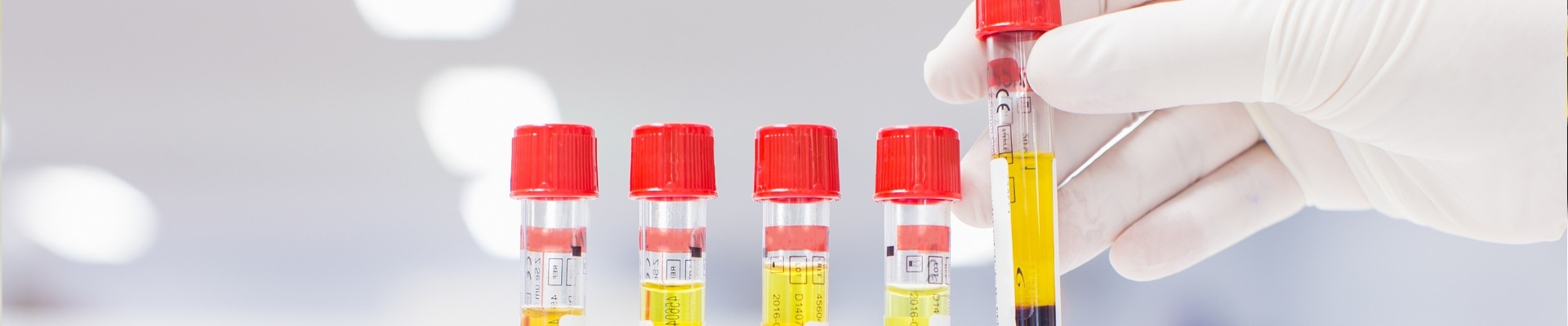 &Epsilon;&xi;&epsilon;&tau;ά&sigma;&epsilon;&iota;&sigmaf; &Kappa;&omicron;&pi;&rho;ά&nu;&omega;&nu; & &Omicron;ύ&rho;&omega;&nu; l &Kappa;&omicron;&sigma;&mu;&omicron;&iota;&alpha;&tau;&rho;&iota;&kappa;ή