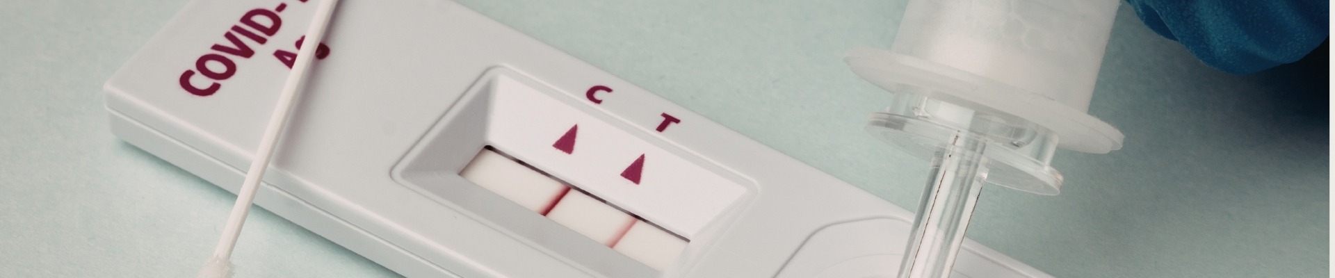 Τεστ Ταχείας Ανίχνευσης Covid-19 Κορωνοϊού (Rapid Test) l Κοσμοιατρική