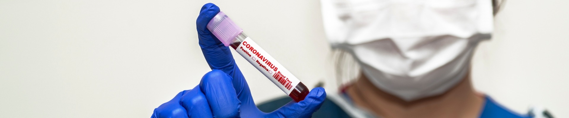 &Tau;&epsilon;&sigma;&tau; &alpha;&nu;ί&chi;&nu;&epsilon;&upsilon;&sigma;&eta;&sigmaf; &omicron;&lambda;&iota;&kappa;ώ&nu; &alpha;&nu;&tau;&iota;&sigma;&omega;&mu;ά&tau;&omega;&nu; έ&nu;&alpha;&nu;&tau;&iota; &tau;&omicron;&upsilon; &Kappa;&omicron;&rho;&omega;&nu;&omicron;ϊ&omicron;ύ l &Kappa;&omicron;&sigma;&mu;&omicron;&iota;&alpha;&tau;&rho;&iota;&kappa;ή