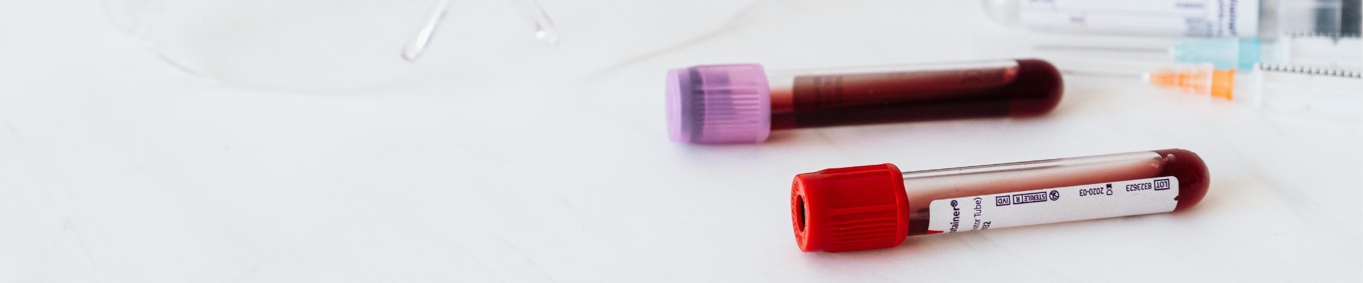 &Tau;&epsilon;&sigma;&tau; &alpha;&nu;ί&chi;&nu;&epsilon;&upsilon;&sigma;&eta;&sigmaf; IgG &alpha;&nu;&tau;&iota;&sigma;&omega;&mu;ά&tau;&omega;&nu; έ&nu;&alpha;&nu;&tau;&iota; &tau;&omicron;&upsilon; &Kappa;&omicron;&rho;&omega;&nu;&omicron;ϊ&omicron;ύ l &Kappa;&omicron;&sigma;&mu;&omicron;&iota;&alpha;&tau;&rho;&iota;&kappa;ή