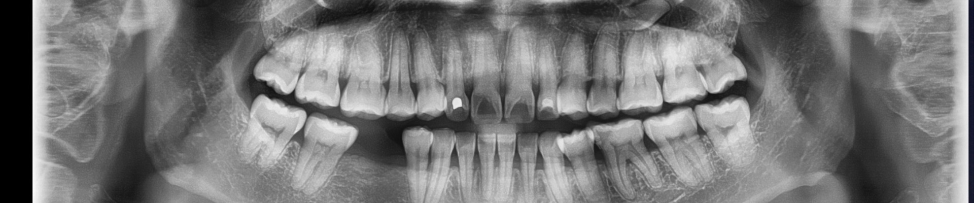 &Psi;&eta;&phi;&iota;&alpha;&kappa;ή &Alpha;&pi;&epsilon;&iota;&kappa;ό&nu;&iota;&sigma;&eta; &Omicron;&delta;ό&nu;&tau;&omega;&nu; l &Kappa;&omicron;&sigma;&mu;&omicron;&iota;&alpha;&tau;&rho;&iota;&kappa;ή
