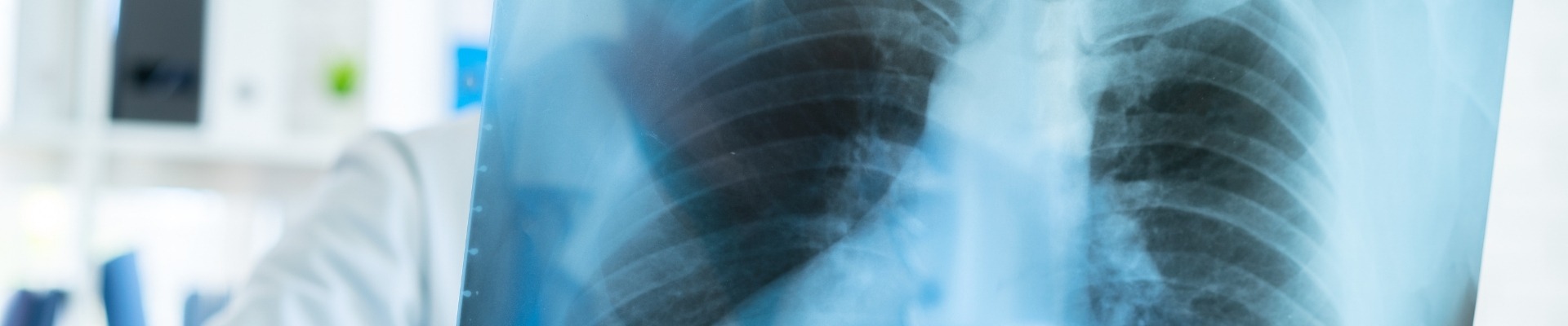 Spirometrisi